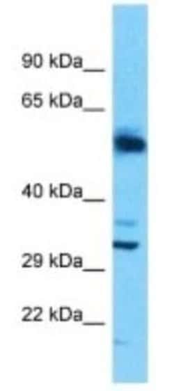 SLC25A30 Rabbit anti-Human, Polyclonal, Novus Biologicals 100 &mu;g | Buy Online | Novus Biologicals | Fisher Scientific